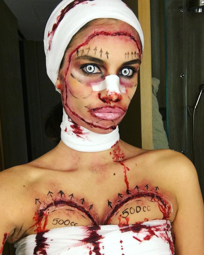 ซาร่า Sampaio as a victim of bad plastic surgery